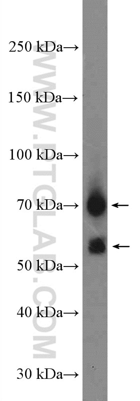 Western Blot (WB) analysis of mouse brain tissue using CHST15 Polyclonal antibody (14131-1-AP)