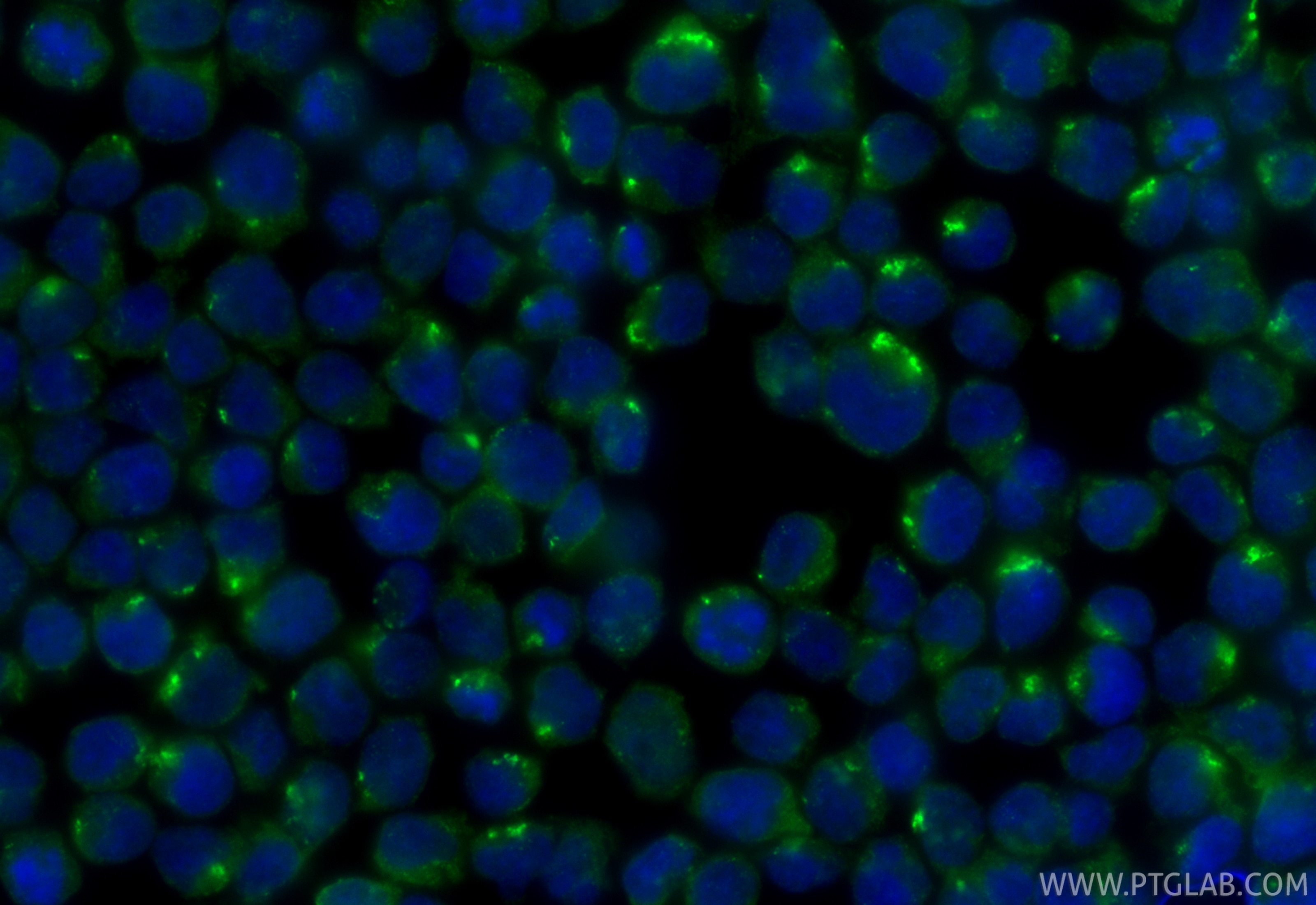 Immunofluorescence (IF) / fluorescent staining of Jurkat cells using CHST15 Polyclonal antibody (14298-1-AP)