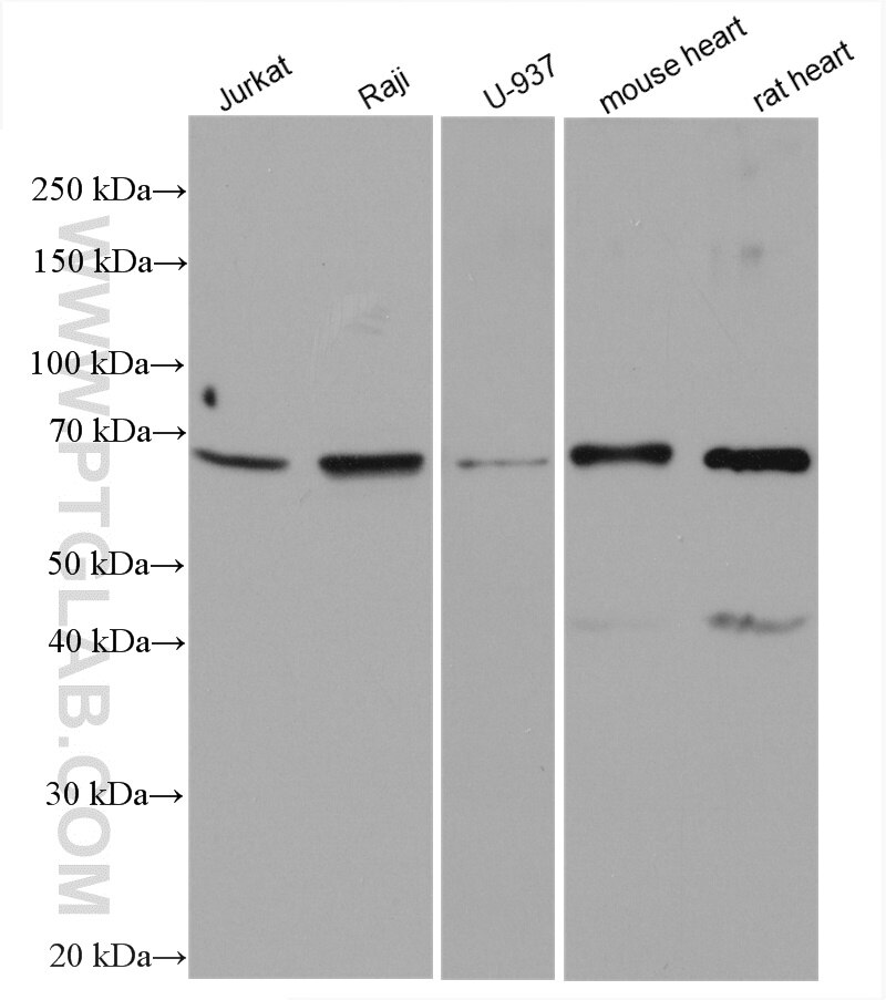 Western Blot (WB) analysis of various lysates using CHST15 Polyclonal antibody (14298-1-AP)