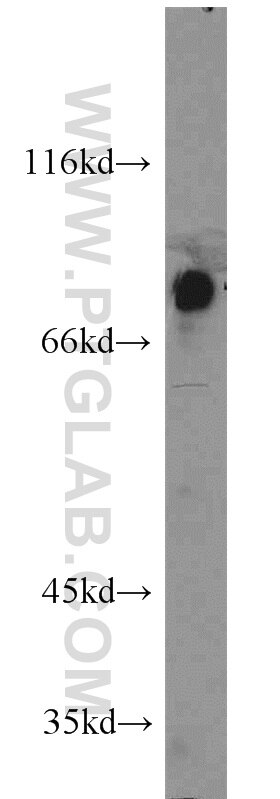 WB analysis of mouse spleen using 14298-1-AP