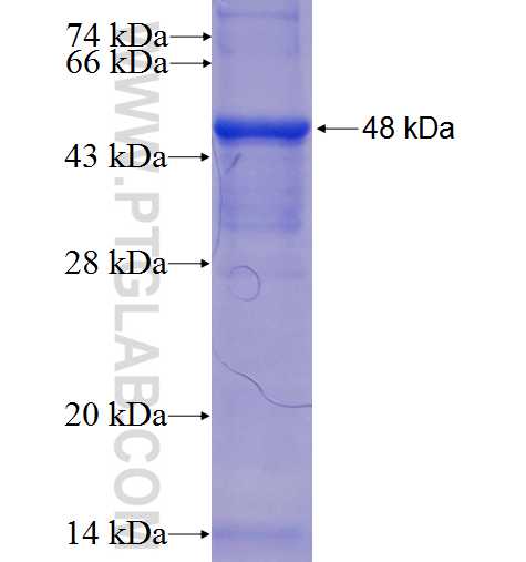 CHST15 fusion protein Ag5901 SDS-PAGE