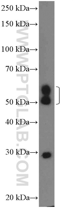 Western Blot (WB) analysis of mouse brain tissue using CHST2 Polyclonal antibody (26027-1-AP)