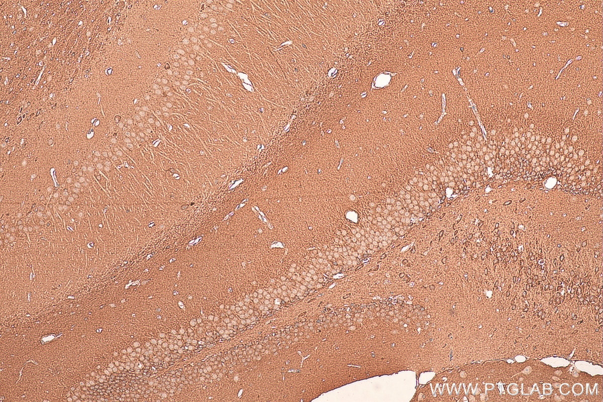 Immunohistochemistry (IHC) staining of mouse brain tissue using CHST3 Polyclonal antibody (18242-1-AP)
