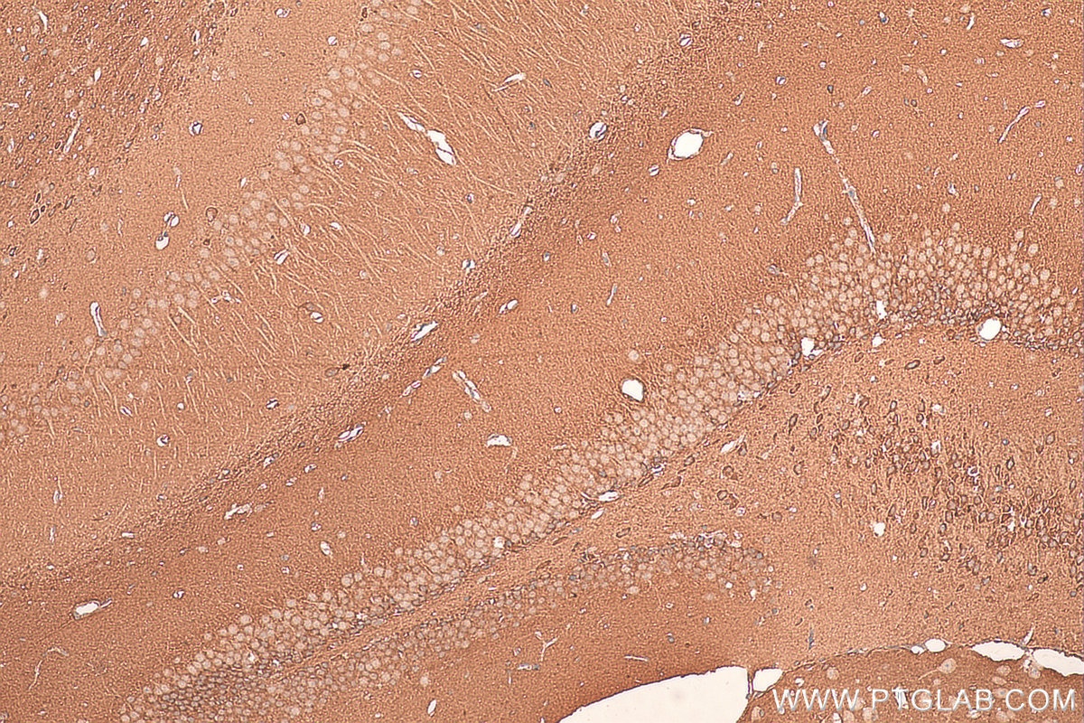 IHC staining of mouse brain using 18242-1-AP