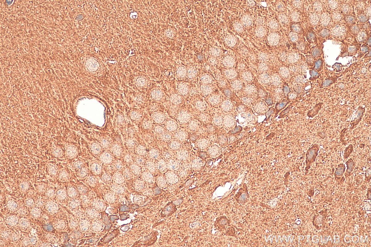 Immunohistochemistry (IHC) staining of mouse brain tissue using CHST3 Polyclonal antibody (18242-1-AP)