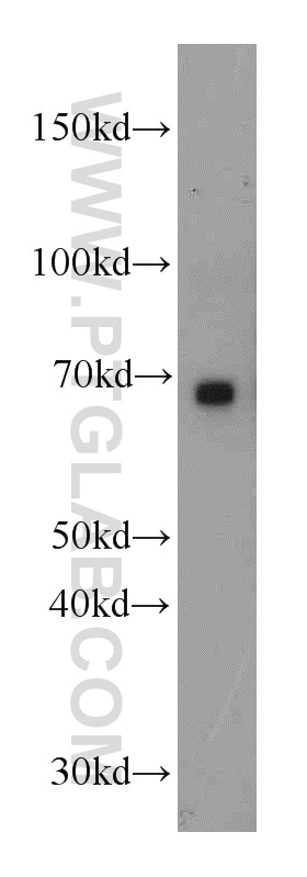 Western Blot (WB) analysis of mouse heart tissue using CHST3 Polyclonal antibody (18242-1-AP)