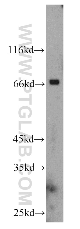 Western Blot (WB) analysis of mouse heart tissue using CHST3 Polyclonal antibody (18242-1-AP)