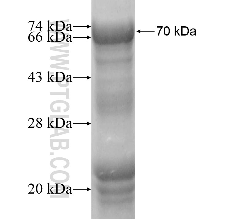 CHST3 fusion protein Ag13008 SDS-PAGE