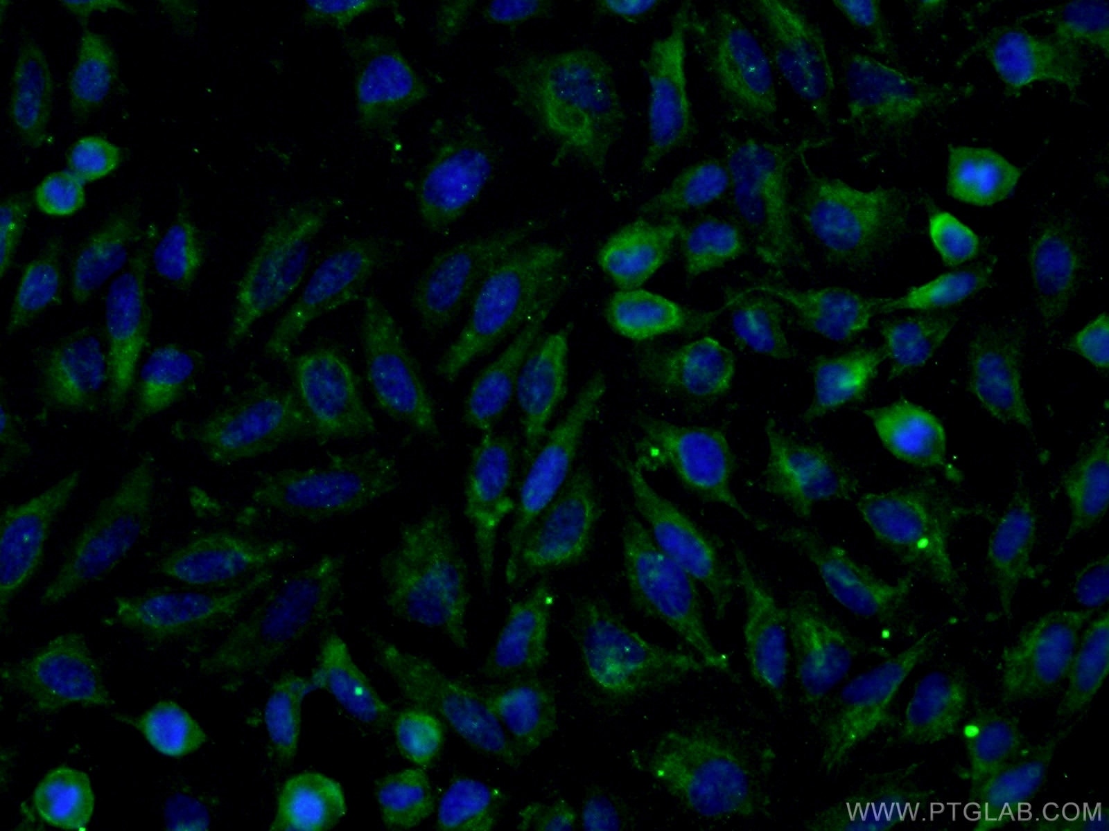 Immunofluorescence (IF) / fluorescent staining of HeLa cells using CHST4 Monoclonal antibody (66623-1-Ig)