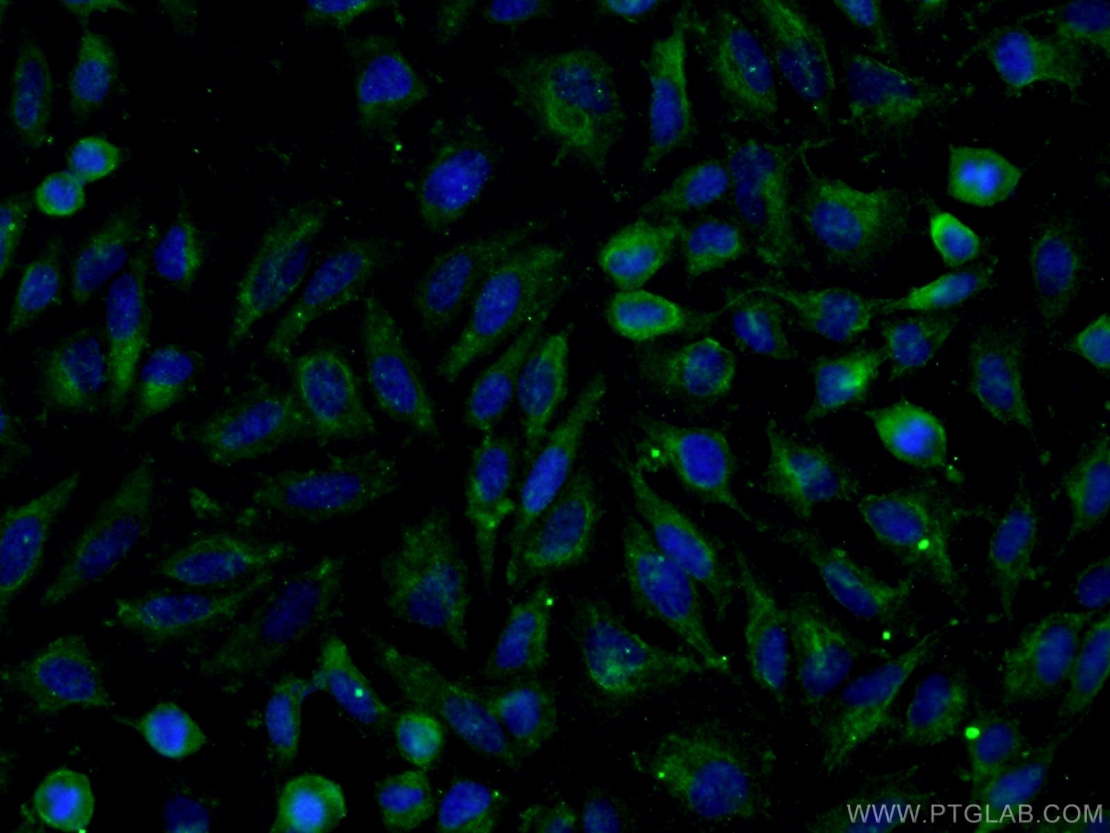 IF Staining of HeLa using 66623-1-Ig