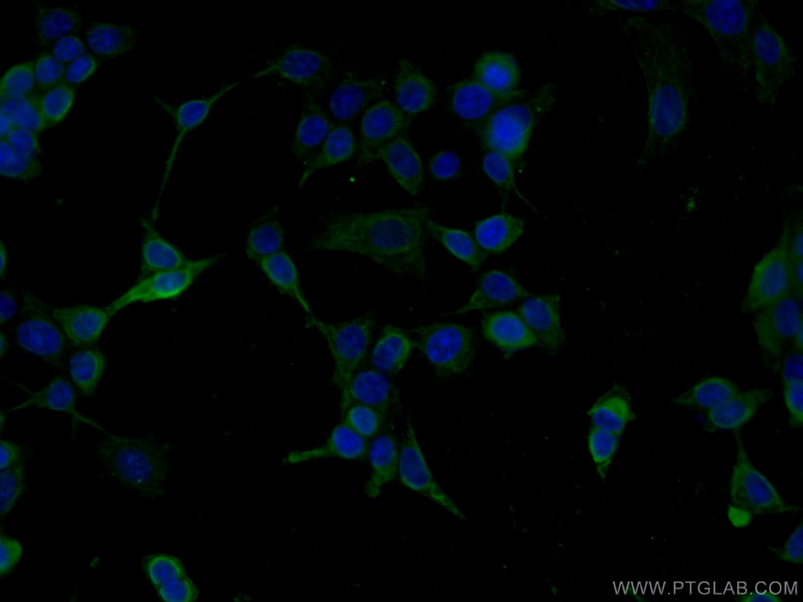 Immunofluorescence (IF) / fluorescent staining of MCF-7 cells using CHST4 Monoclonal antibody (66623-1-Ig)