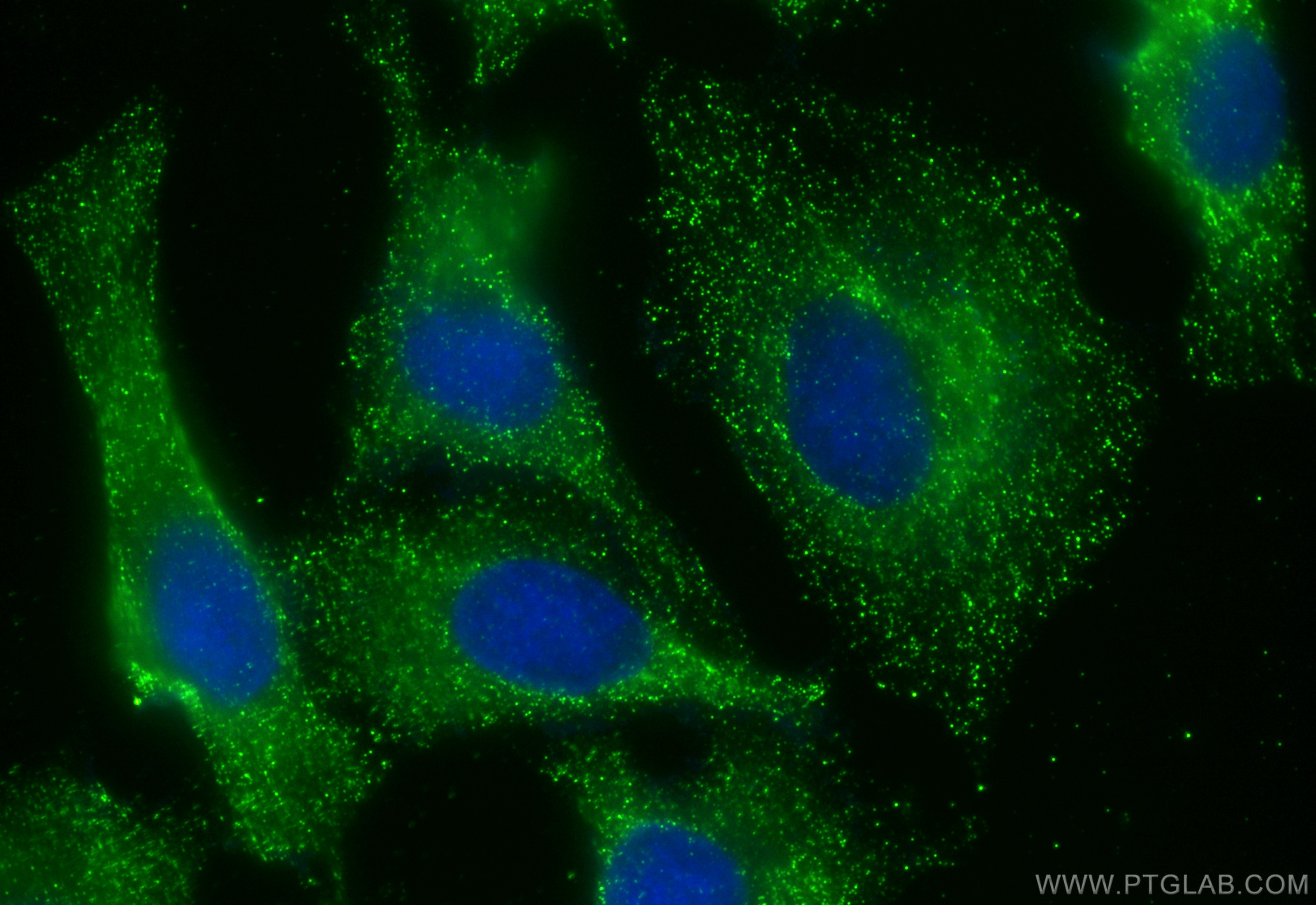 Immunofluorescence (IF) / fluorescent staining of HeLa cells using CHST4 Monoclonal antibody (66623-1-Ig)