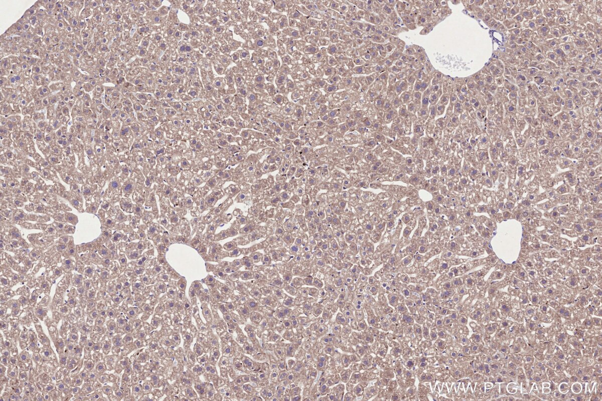 Immunohistochemistry (IHC) staining of mouse liver tissue using CHST4 Monoclonal antibody (66623-1-Ig)