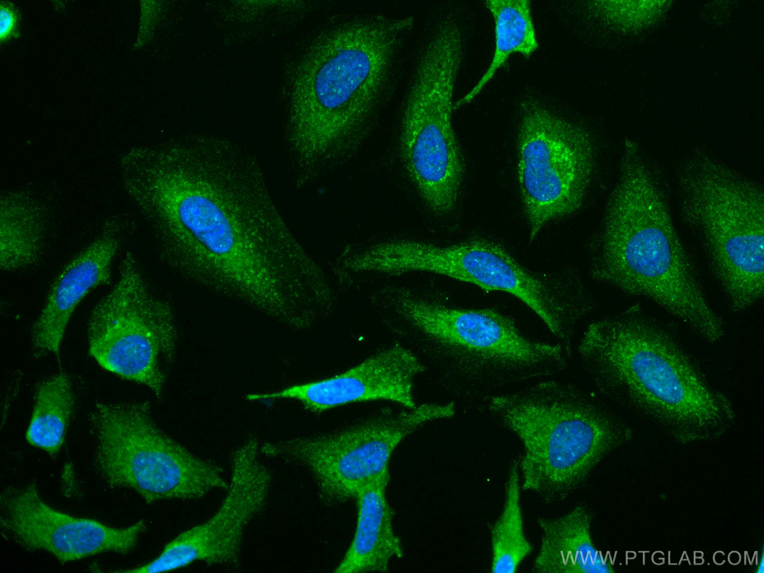 Immunofluorescence (IF) / fluorescent staining of HeLa cells using CoraLite® Plus 488-conjugated CHST4 Monoclonal ant (CL488-66623)