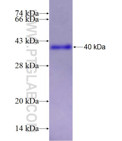 CHST4 fusion protein Ag3987 SDS-PAGE