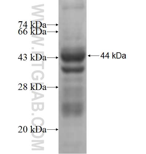 CHST7 fusion protein Ag5722 SDS-PAGE