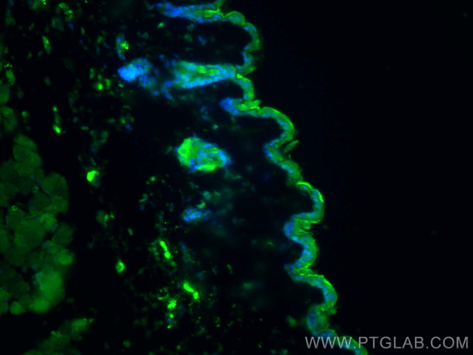 Immunofluorescence (IF) / fluorescent staining of mouse skin tissue using CHST8 Polyclonal antibody (16426-1-AP)