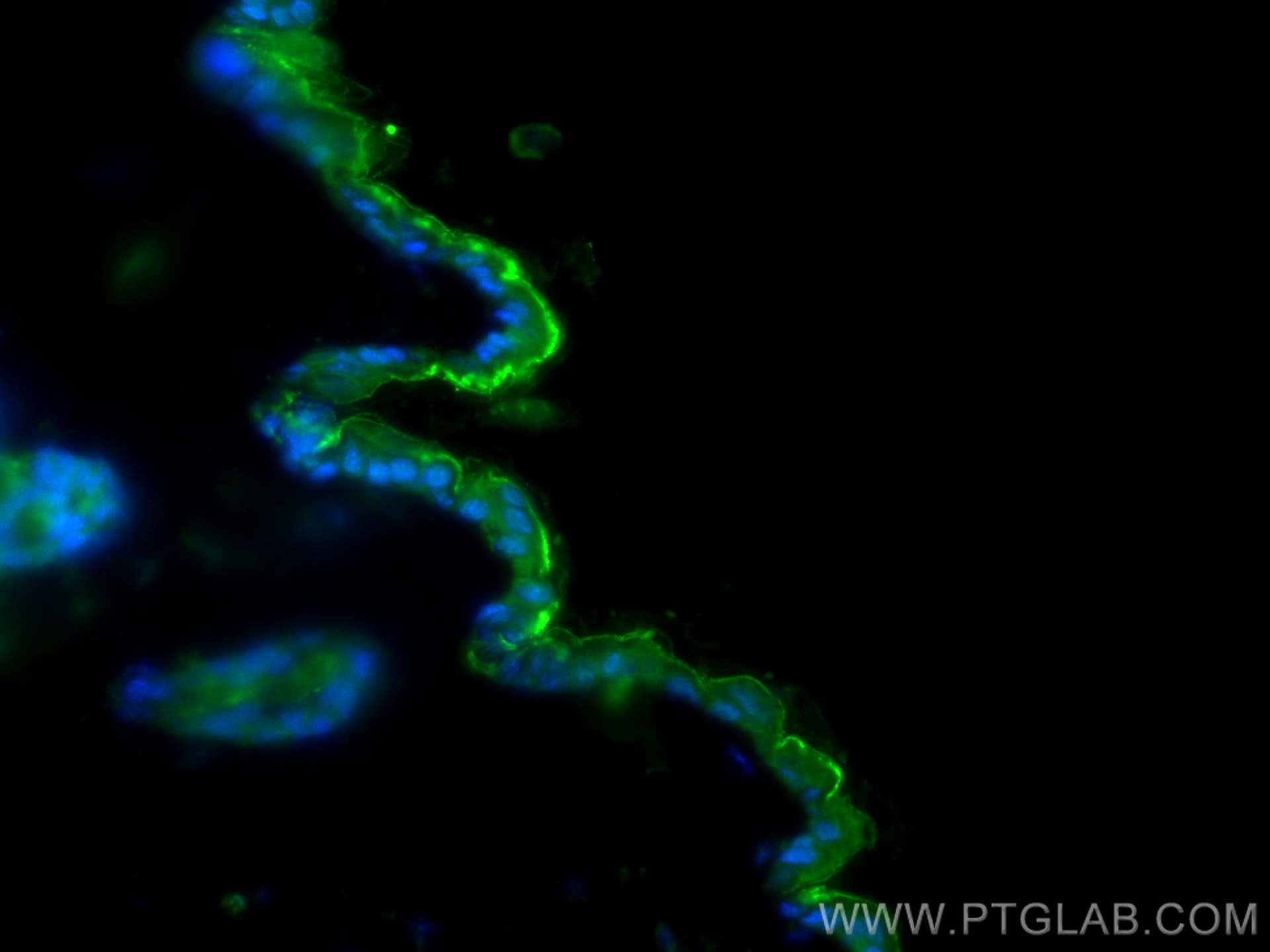 Immunofluorescence (IF) / fluorescent staining of mouse skin tissue using CHST8 Polyclonal antibody (16426-1-AP)