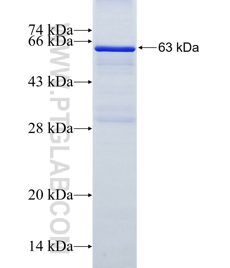 CHST8 fusion protein Ag9669 SDS-PAGE