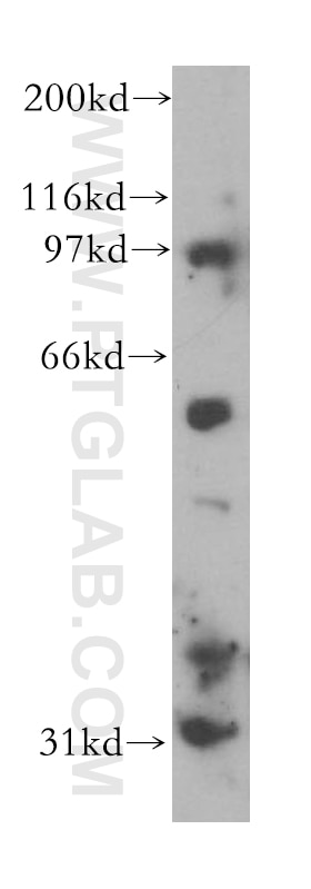 Western Blot (WB) analysis of HepG2 cells using CHST9 Polyclonal antibody (13135-1-AP)