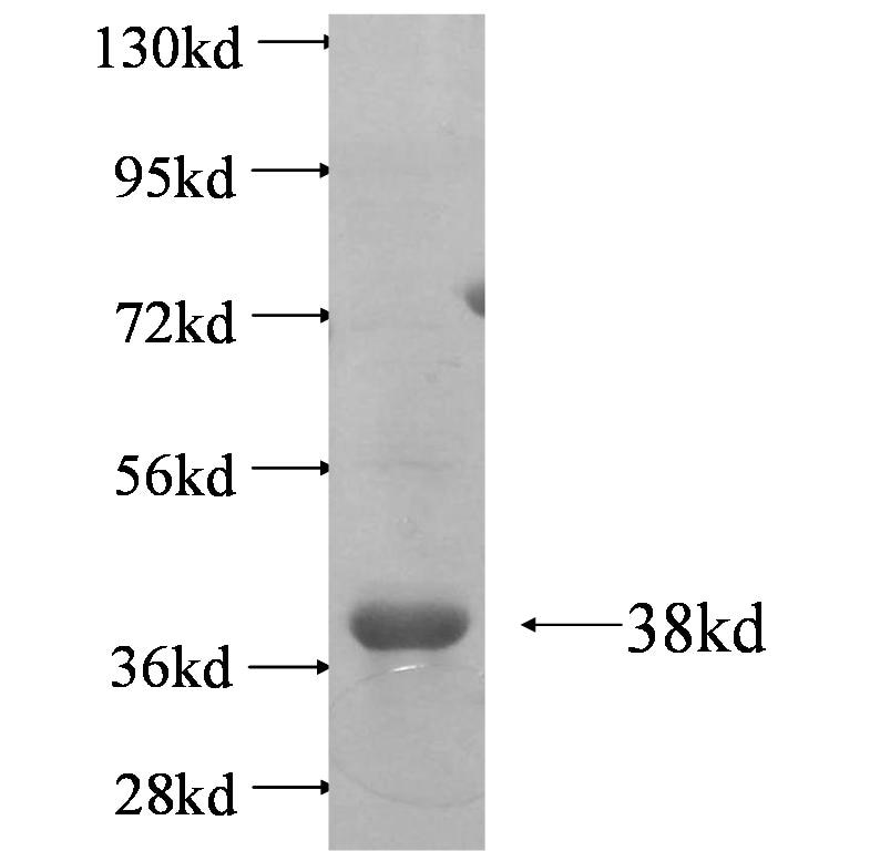 CHST9 fusion protein Ag4410 SDS-PAGE