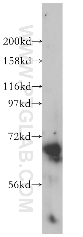 WB analysis of mouse spleen using 14420-1-AP