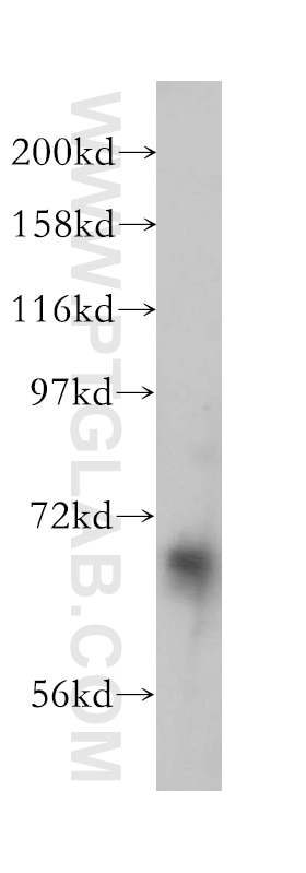 Western Blot (WB) analysis of mouse heart tissue using CHSY1 Polyclonal antibody (14420-1-AP)