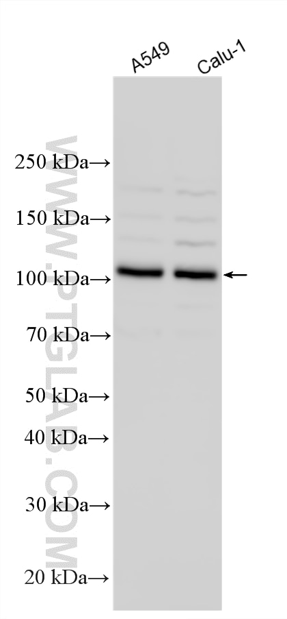 WB analysis using 24444-1-AP Western Blot (WB) analysis of various lysates using CHSY3 Polyclonal antibody (24444-1-AP)