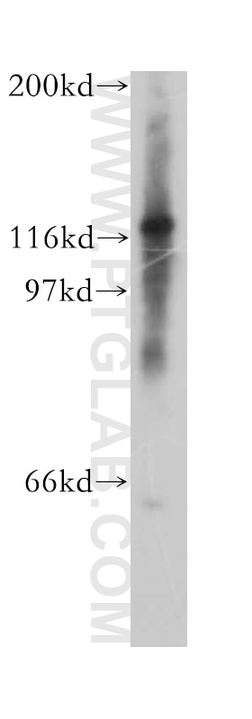 Western Blot (WB) analysis of Y79 cells using CHTF18 Polyclonal antibody (13030-1-AP)