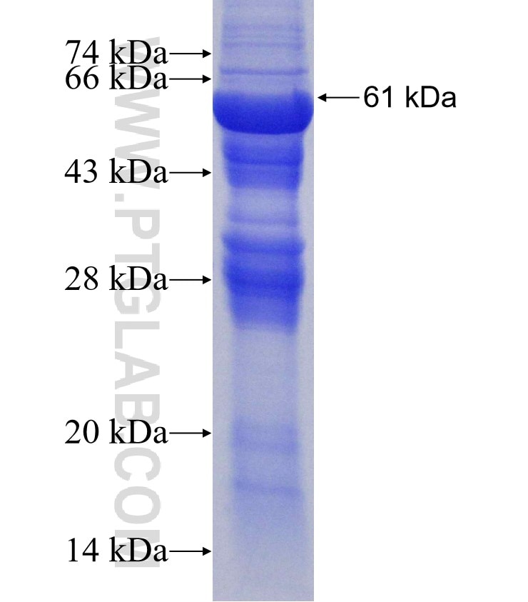 CHTF18 fusion protein Ag3672 SDS-PAGE