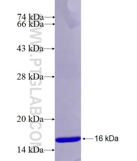 CHUK fusion protein Ag26549 SDS-PAGE