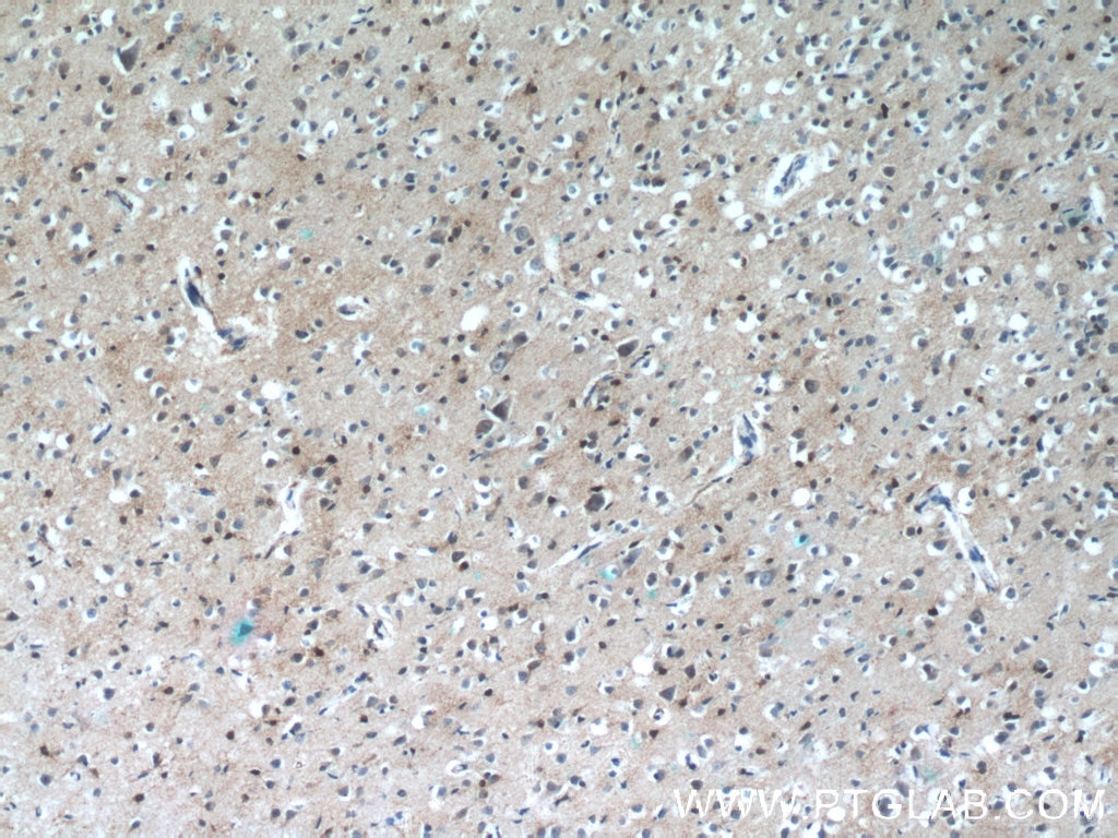 Immunohistochemistry (IHC) staining of human brain tissue using CHURC1 Polyclonal antibody (12247-1-AP)