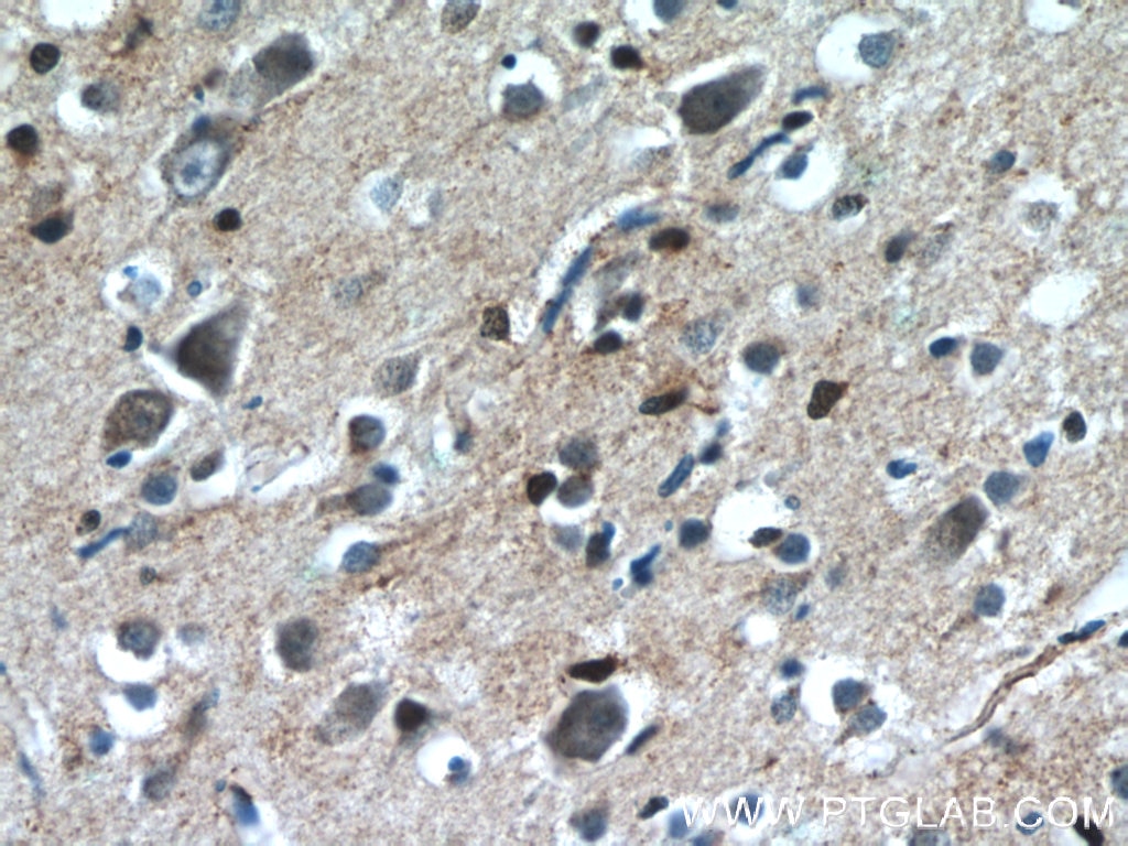 Immunohistochemistry (IHC) staining of human brain tissue using CHURC1 Polyclonal antibody (12247-1-AP)