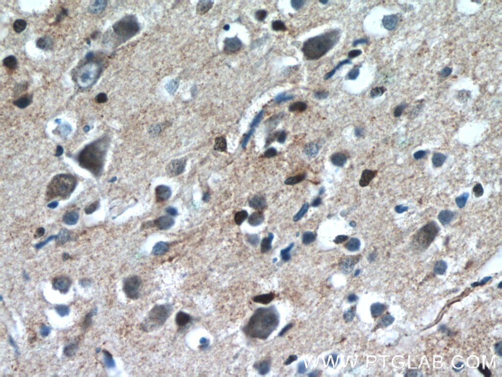 IHC staining of human brain using 12247-1-AP