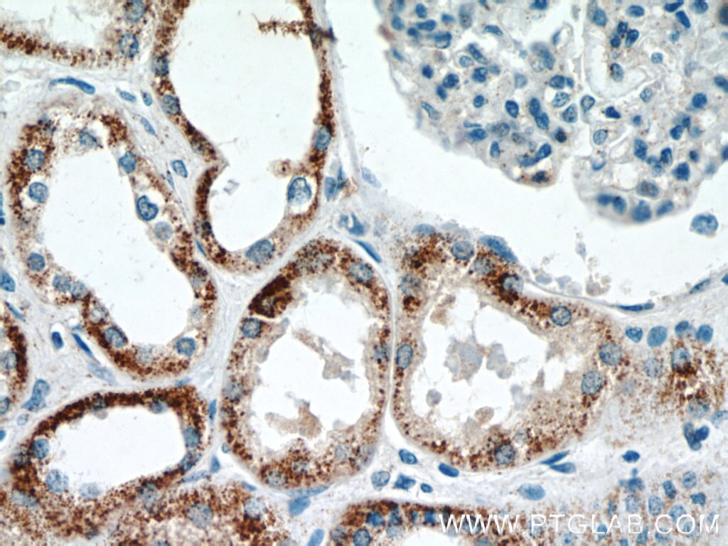 Immunohistochemistry (IHC) staining of human kidney tissue using CHURC1 Polyclonal antibody (12247-1-AP)