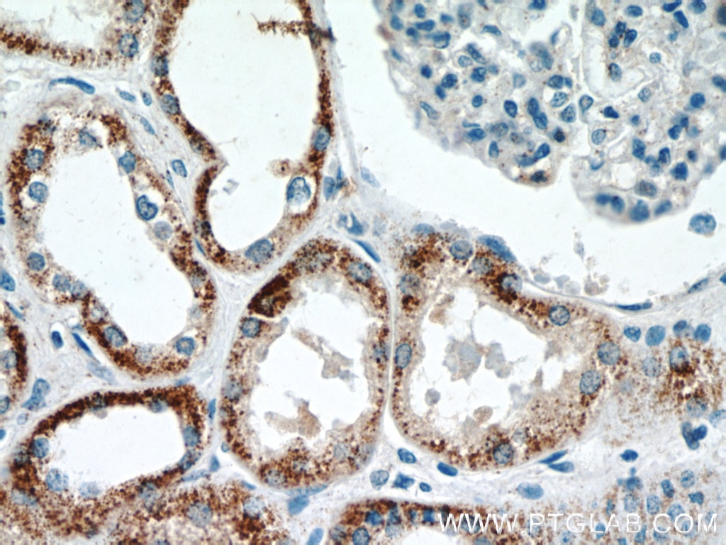 IHC staining of human kidney using 12247-1-AP