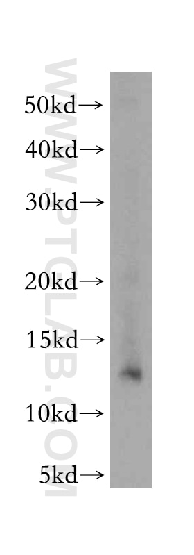 Western Blot (WB) analysis of HeLa cells using CHURC1 Polyclonal antibody (12247-1-AP)