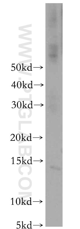 Western Blot (WB) analysis of mouse liver tissue using CHURC1 Polyclonal antibody (12247-1-AP)