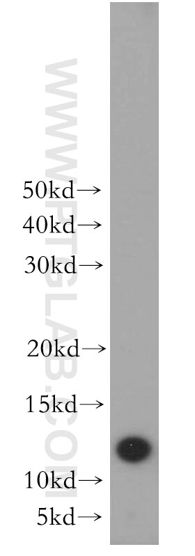 Western Blot (WB) analysis of mouse skin tissue using CHURC1 Polyclonal antibody (12247-1-AP)