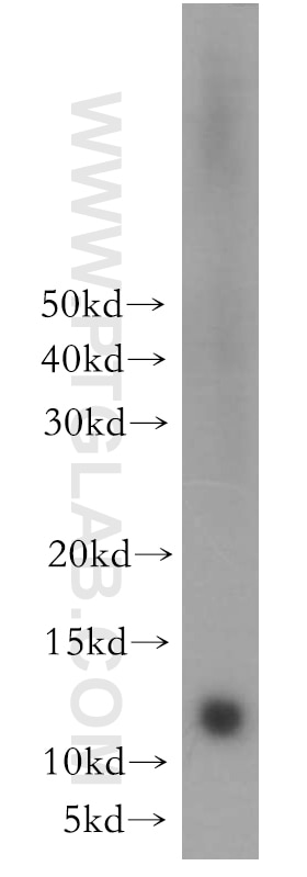 Western Blot (WB) analysis of mouse liver tissue using CHURC1 Polyclonal antibody (12247-1-AP)