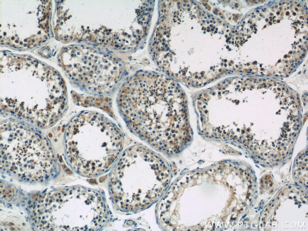 Immunohistochemistry (IHC) staining of human testis tissue using CIAO1 Polyclonal antibody (10295-1-AP)