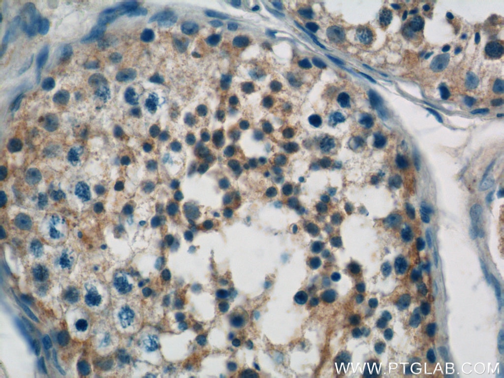 Immunohistochemistry (IHC) staining of human testis tissue using CIAO1 Polyclonal antibody (10295-1-AP)