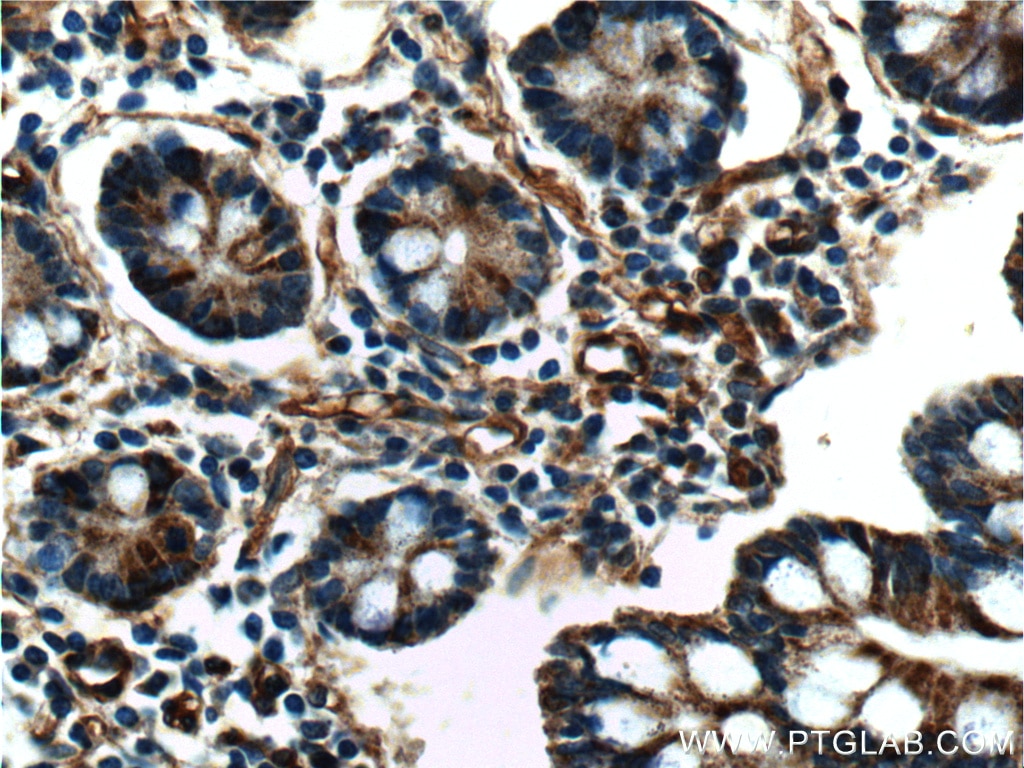 Immunohistochemistry (IHC) staining of human small intestine tissue using CIAO1 Polyclonal antibody (10295-1-AP)