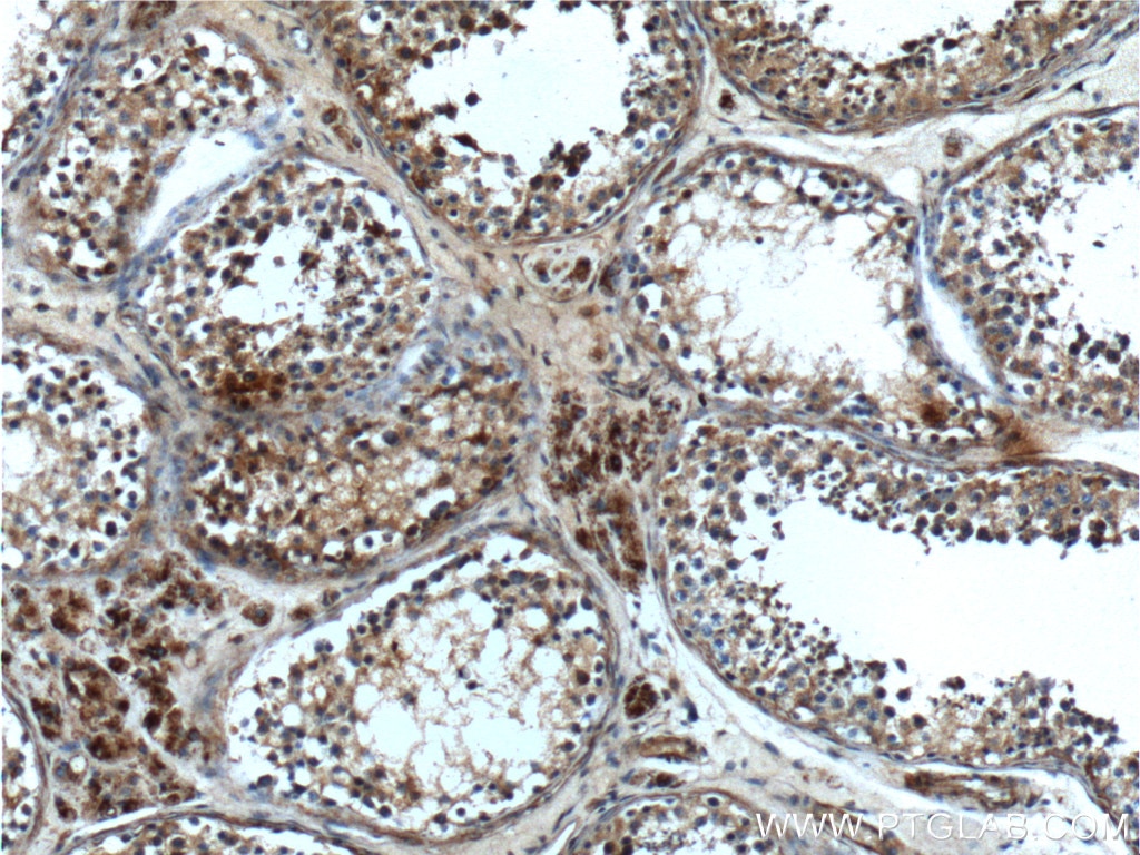 Immunohistochemistry (IHC) staining of human testis tissue using CIAO1 Polyclonal antibody (10295-1-AP)