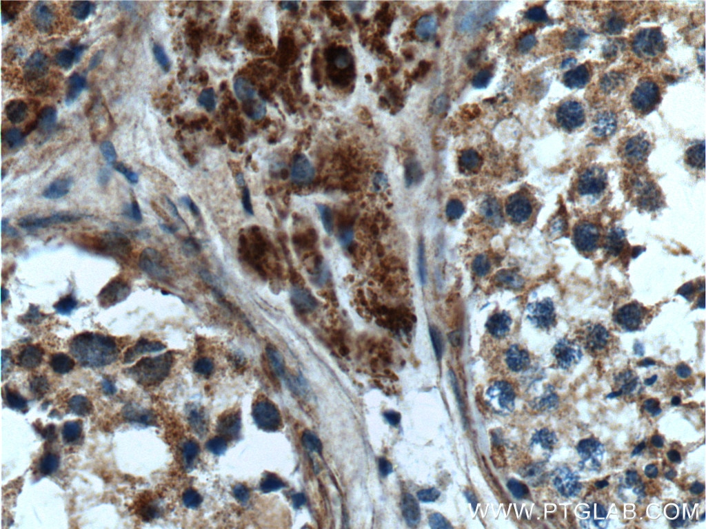 Immunohistochemistry (IHC) staining of human testis tissue using CIAO1 Polyclonal antibody (10295-1-AP)