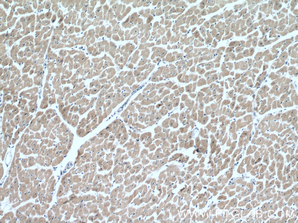 IHC staining of human heart using 12638-1-AP