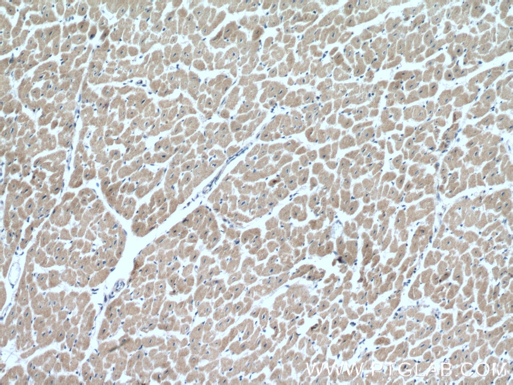 Immunohistochemistry (IHC) staining of human heart tissue using CIAPIN1 Polyclonal antibody (12638-1-AP)