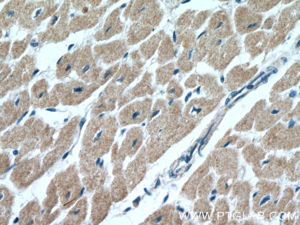 Immunohistochemistry (IHC) staining of human heart tissue using CIAPIN1 Polyclonal antibody (12638-1-AP)