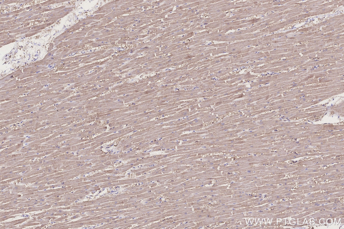 IHC staining of human heart using 68492-1-Ig Immunohistochemistry (IHC) staining of human heart tissue using CIAPIN1 Monoclonal antibody (68492-1-Ig)
