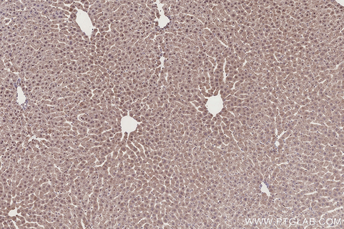 IHC staining of rat liver using 68492-1-Ig Immunohistochemistry (IHC) staining of rat liver tissue using CIAPIN1 Monoclonal antibody (68492-1-Ig)